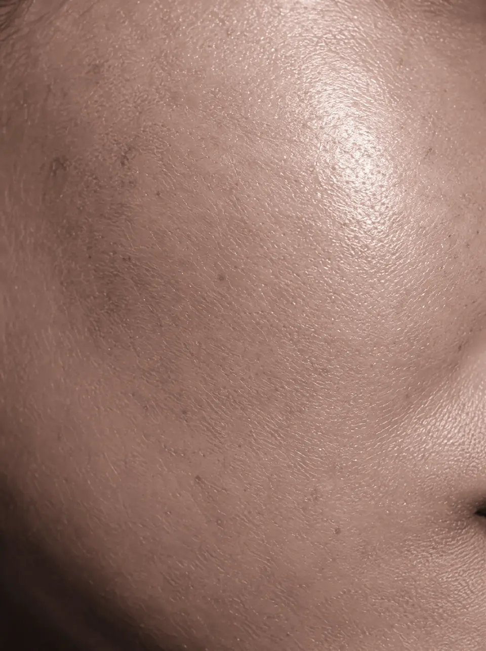 Textura de pele em detalhe (imagem ilustrativa)